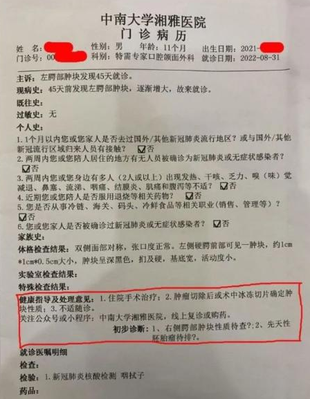 当事医生回应莲子壳诊断为疑似肿瘤