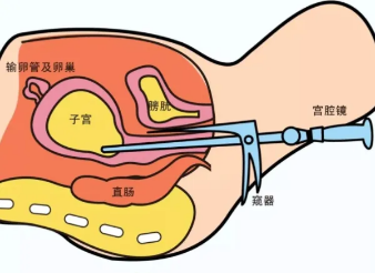 内膜多厚才可以移植