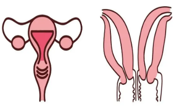 双角子宫试管几率大吗