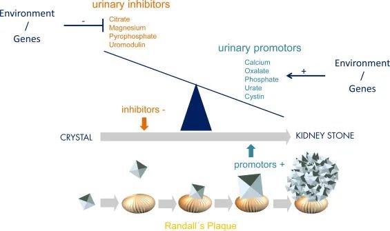 肾结石与基因遗传:肾结石和肾钙质沉着症新疾病基因的鉴定