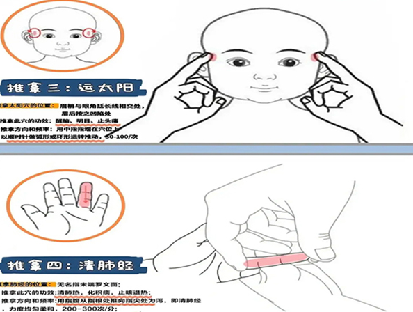 小孩退烧推拿手法及示意图详解,推天河水退烧实在太有效了