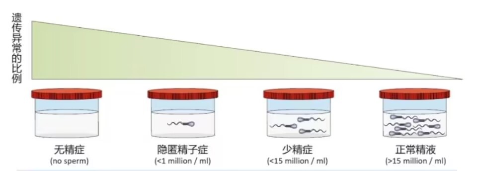 少弱畸形精子症患者遗传学筛查 常染色体显性多囊肾(ADPKD)