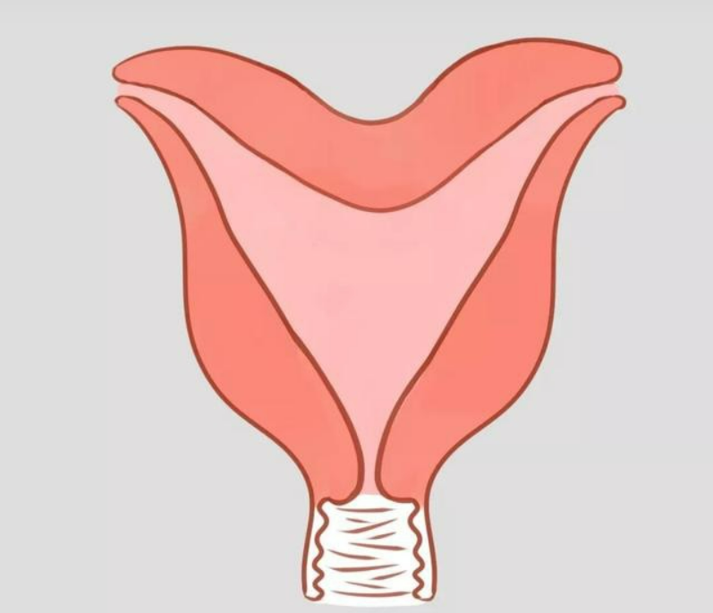 双角子宫双阴道是不是很难怀孕 可以试管吗 