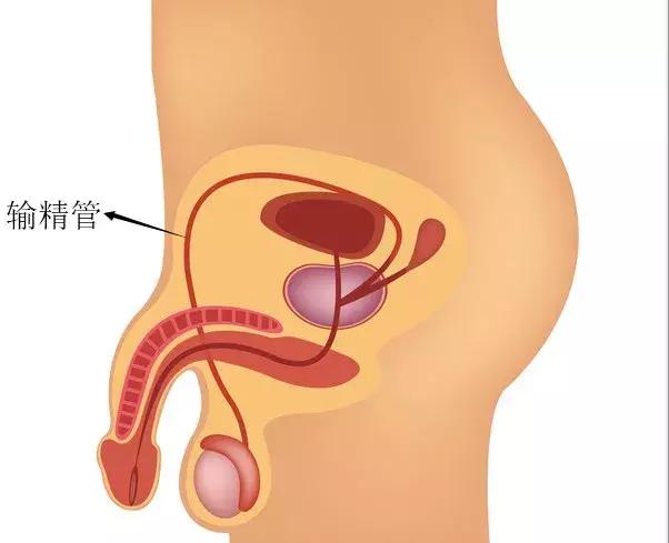 输精管酸痛怎么回事？要留意这5种病因