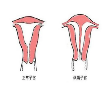 北京治疗宫颈性不孕医院